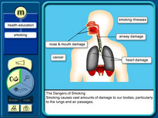 Bodywise anatomy software screen shot